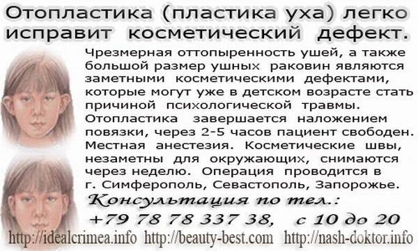 Фото Отопластика (пластика уха) легко исправит косметический дефект Крым