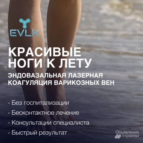 Фото Лечение варикозного расширения вен - ЭВЛК, Харьков